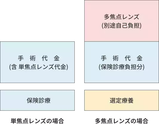 白内障手術のレンズ選択と費用の関係